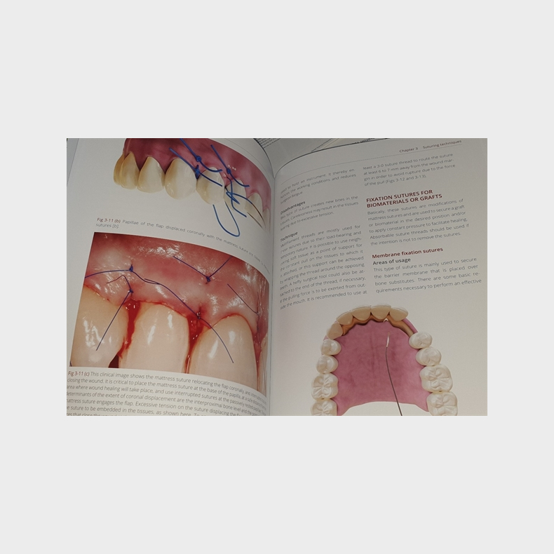 The Art of Dental Suturing - A Clinical Guide